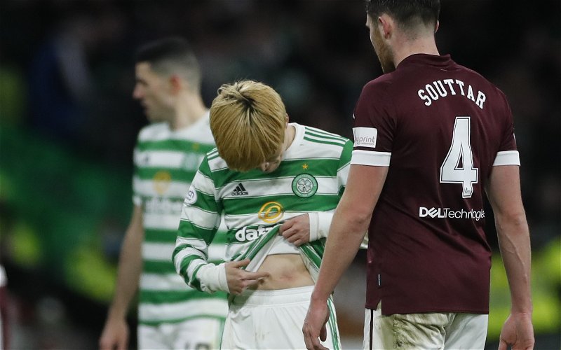 Image for Some buttons pulled out of his ankle- Ibrox agony for Sicknote Souttar