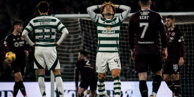 Celtic’s struggles against low blocks